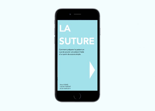 Image - La suture